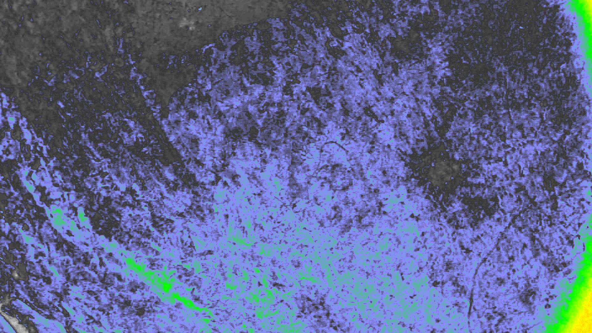 NDVI