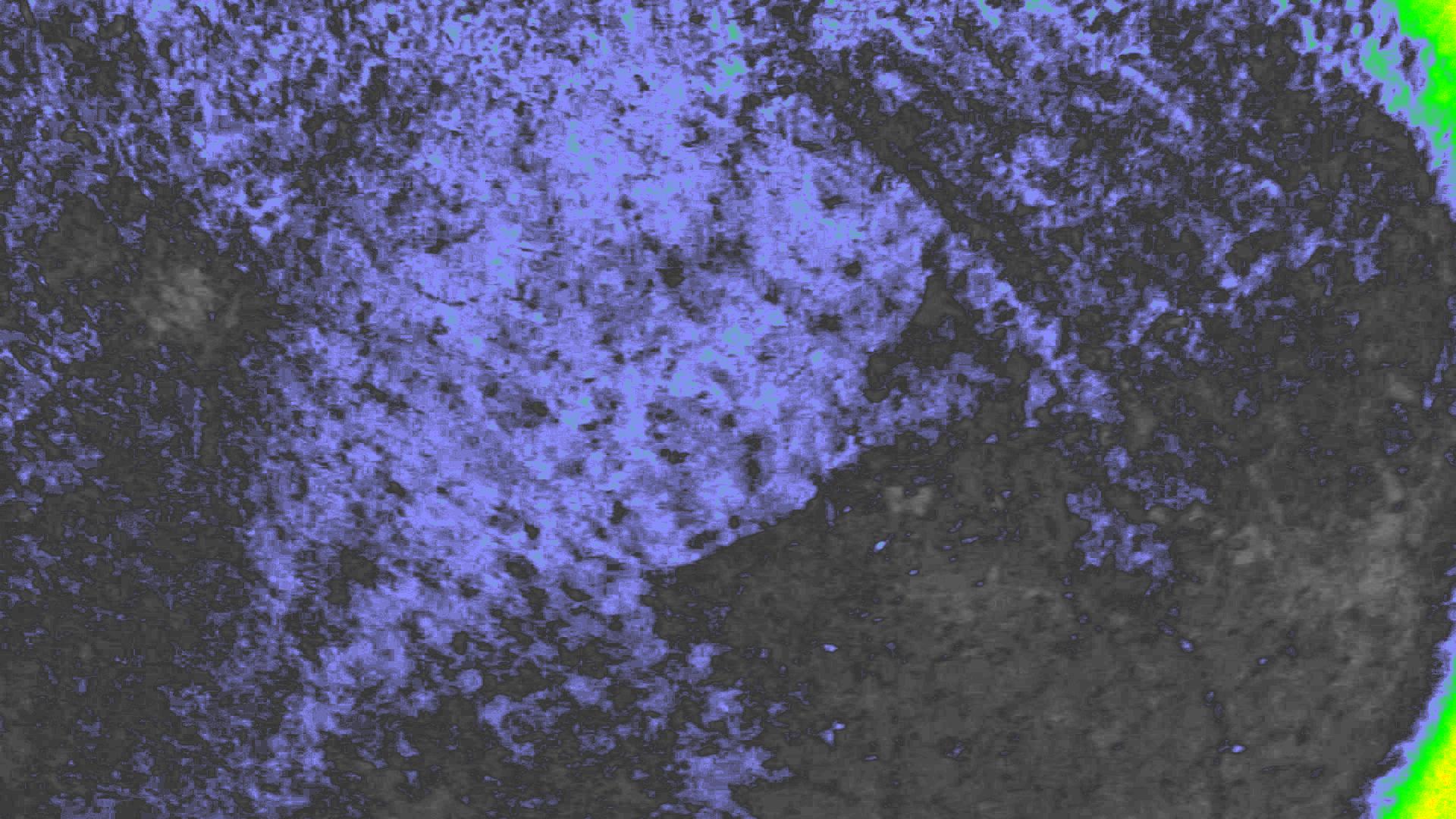 NDVI